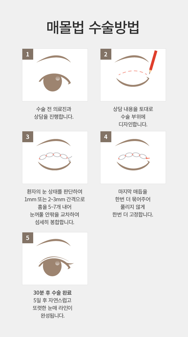 ������-�ֲ�Ǯ