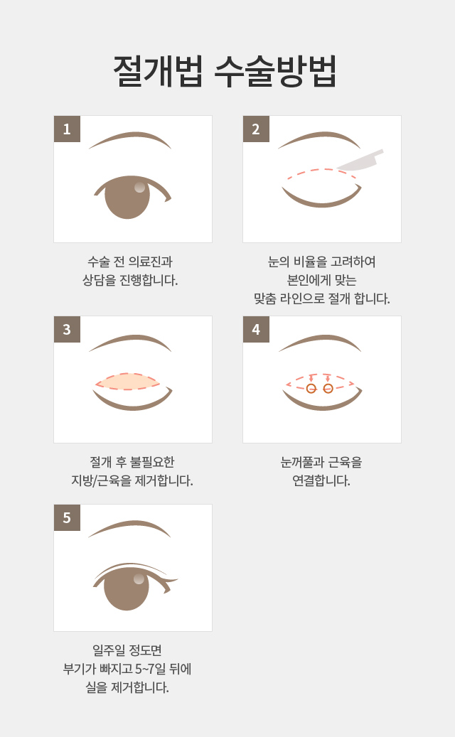 ������-�ֲ�Ǯ