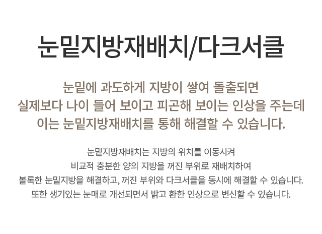 �������� ���ġ/��ũ��Ŭ