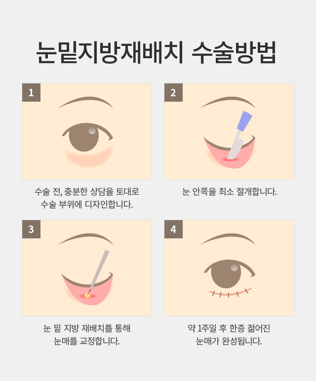 �������� ���ġ/��ũ��Ŭ