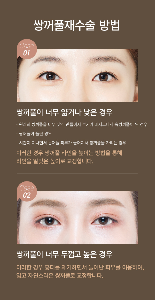 �� �����