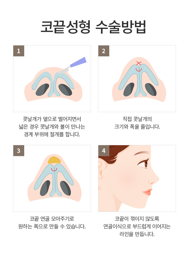 �ڳ�����