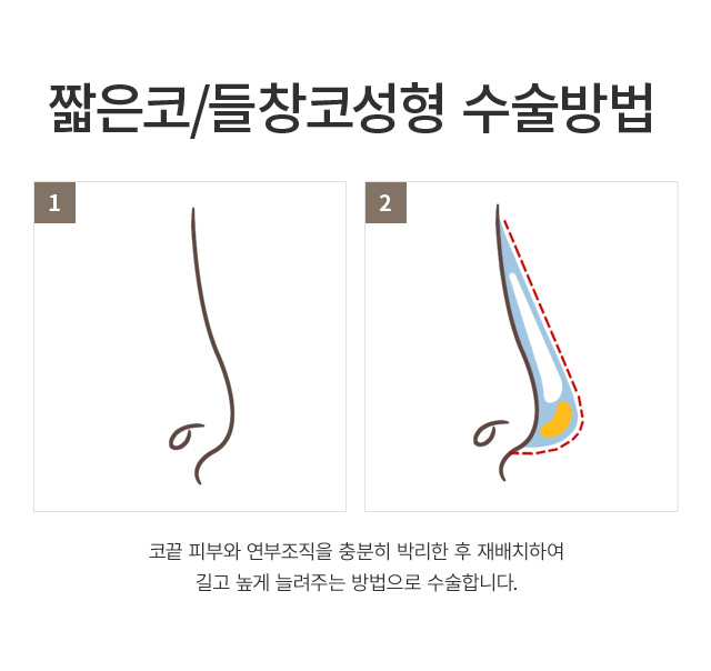 ª����/��â��