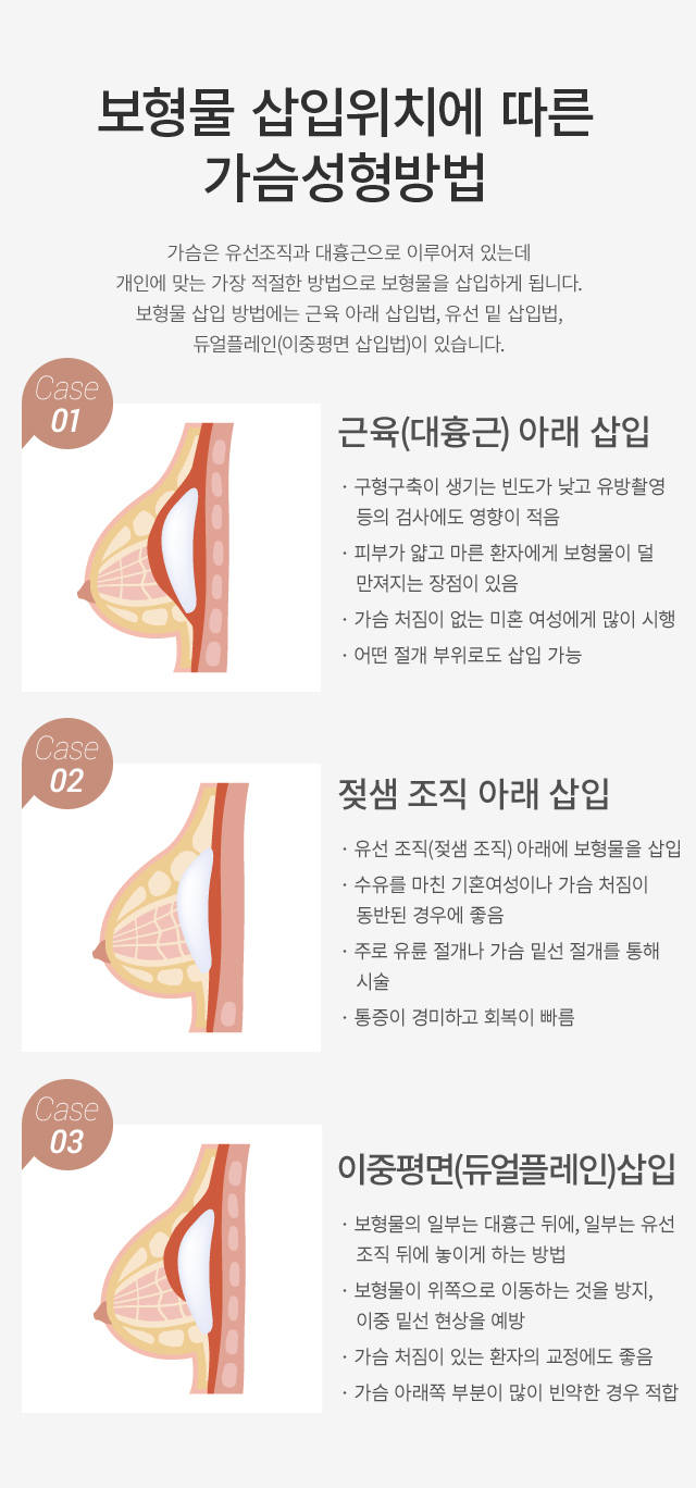 ���� Ȯ��