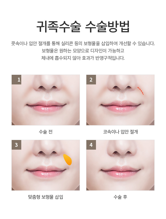 �� ������/��������