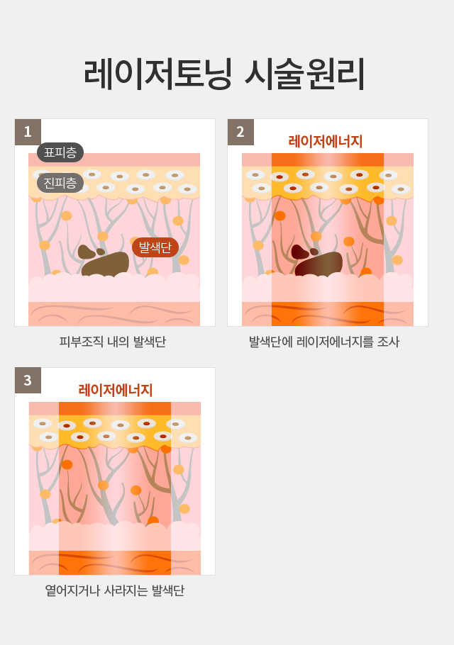 ������ ���