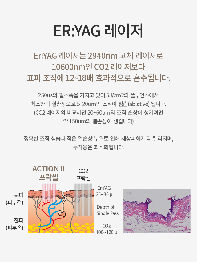 �׼�2 ������