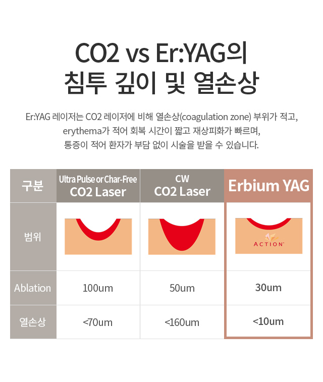 �׼�2 ������