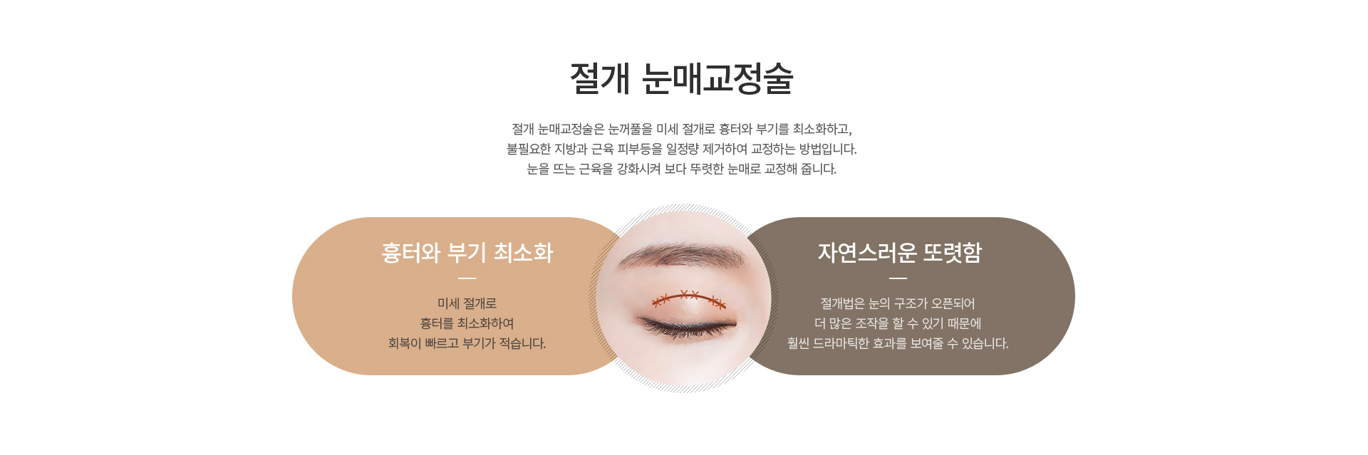 ������-�ֲ�Ǯ