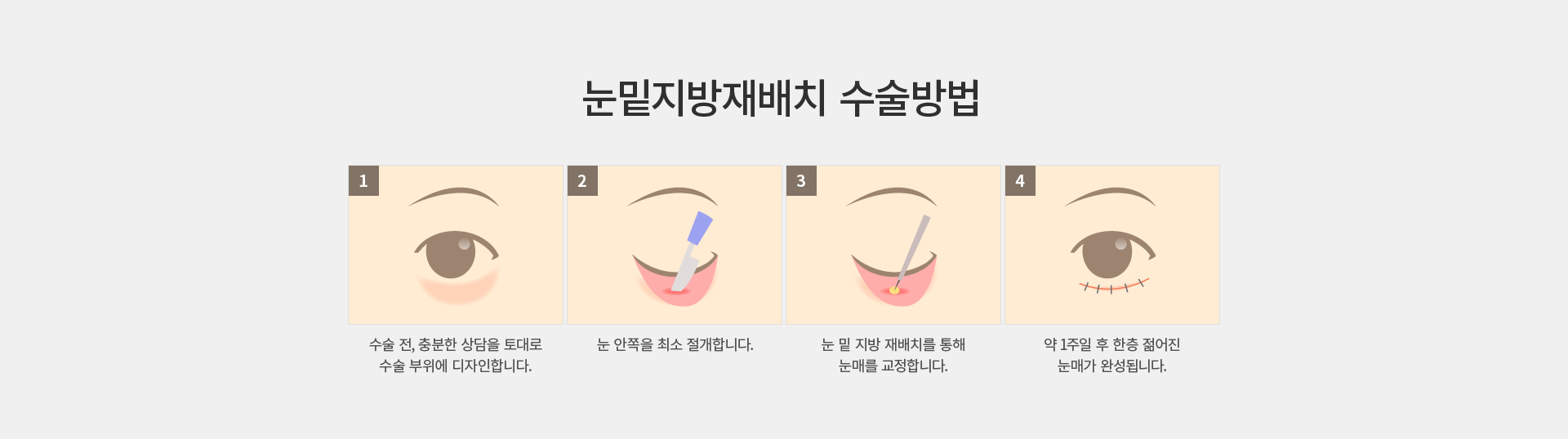 �������� ���ġ/��ũ��Ŭ