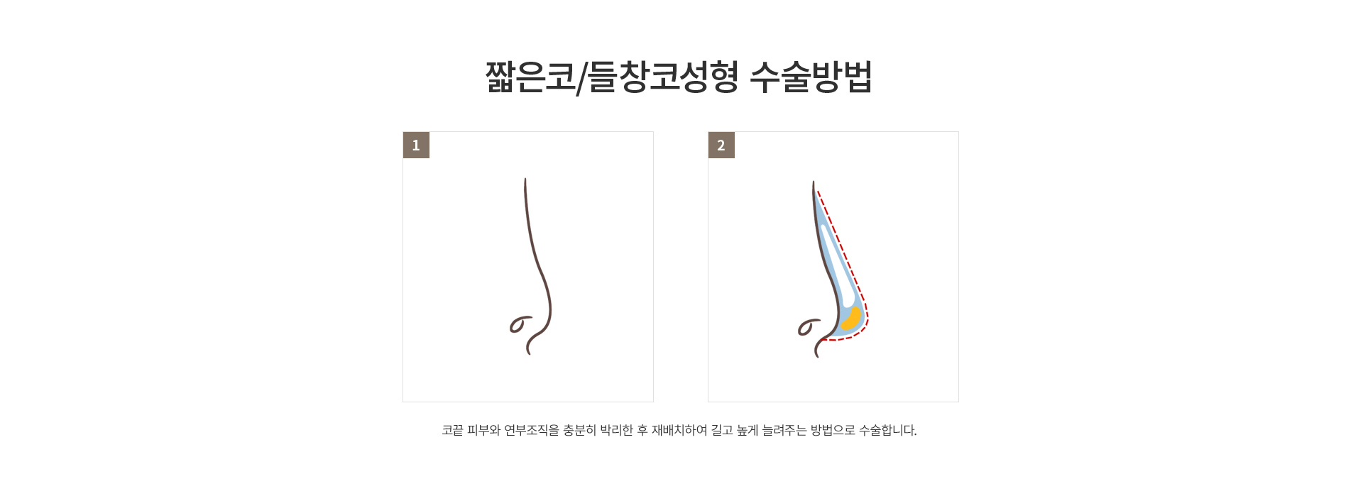 ª����/��â��