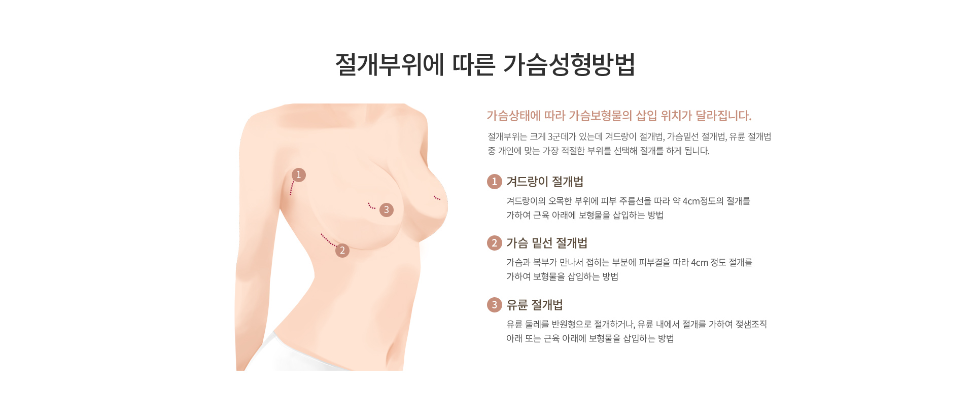 ���� Ȯ��