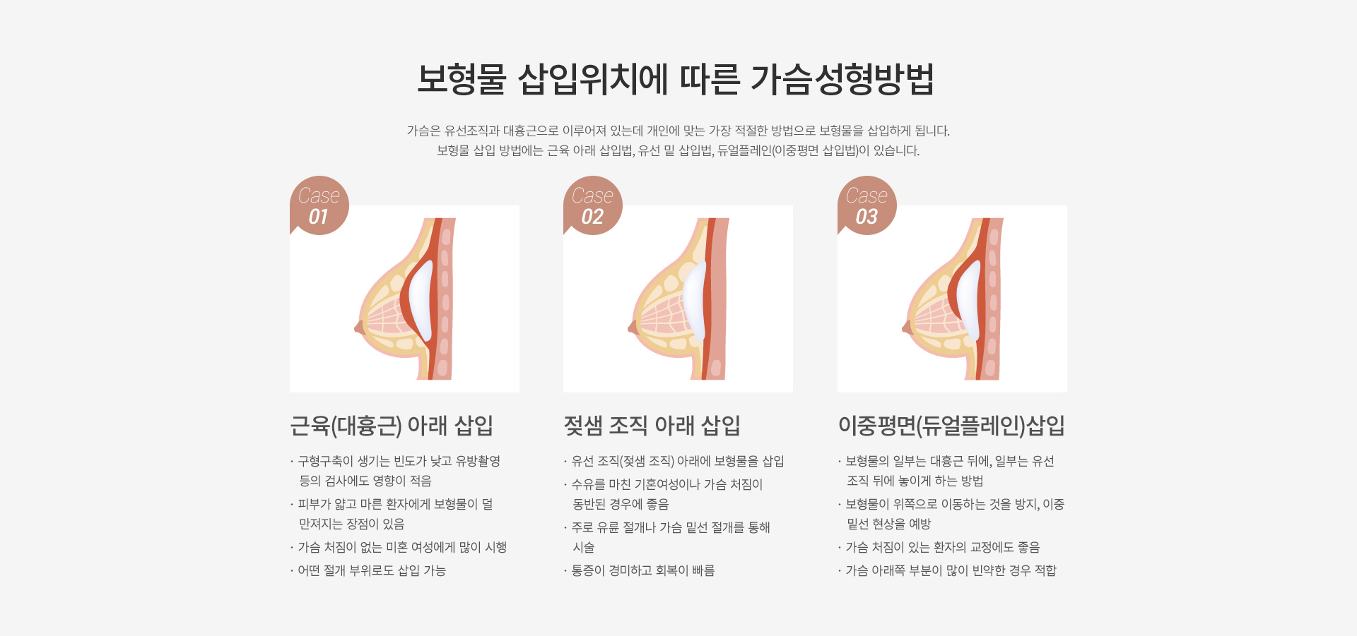 ���� Ȯ��