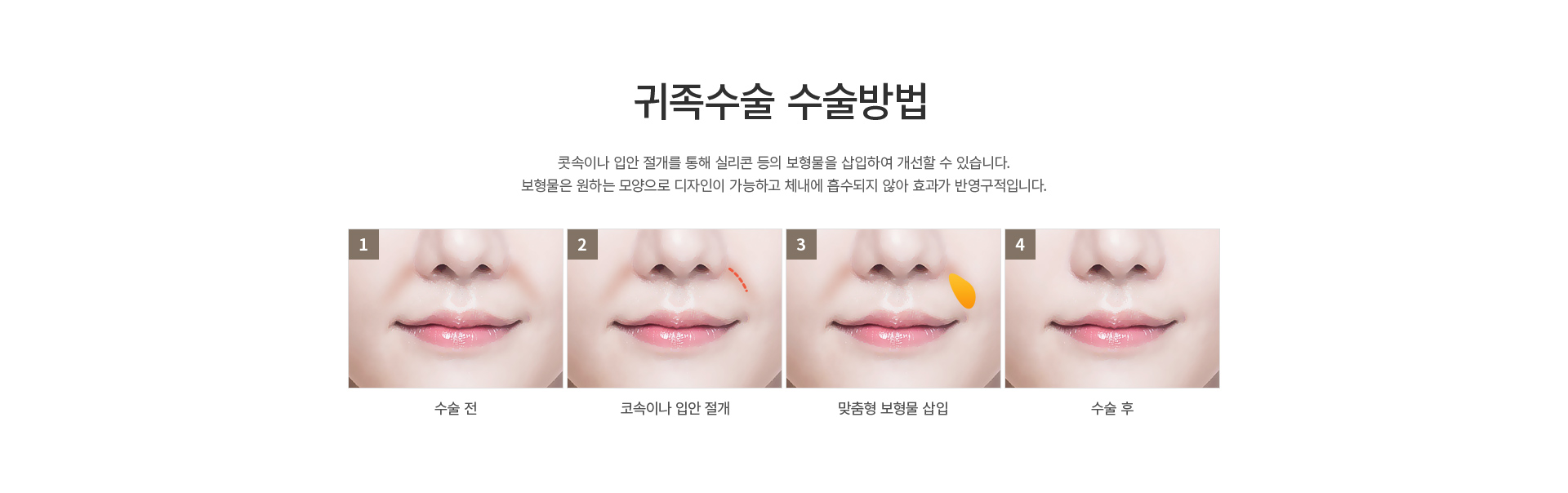 �� ������/��������