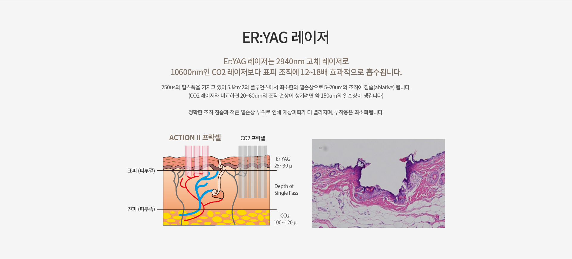 �׼�2 ������